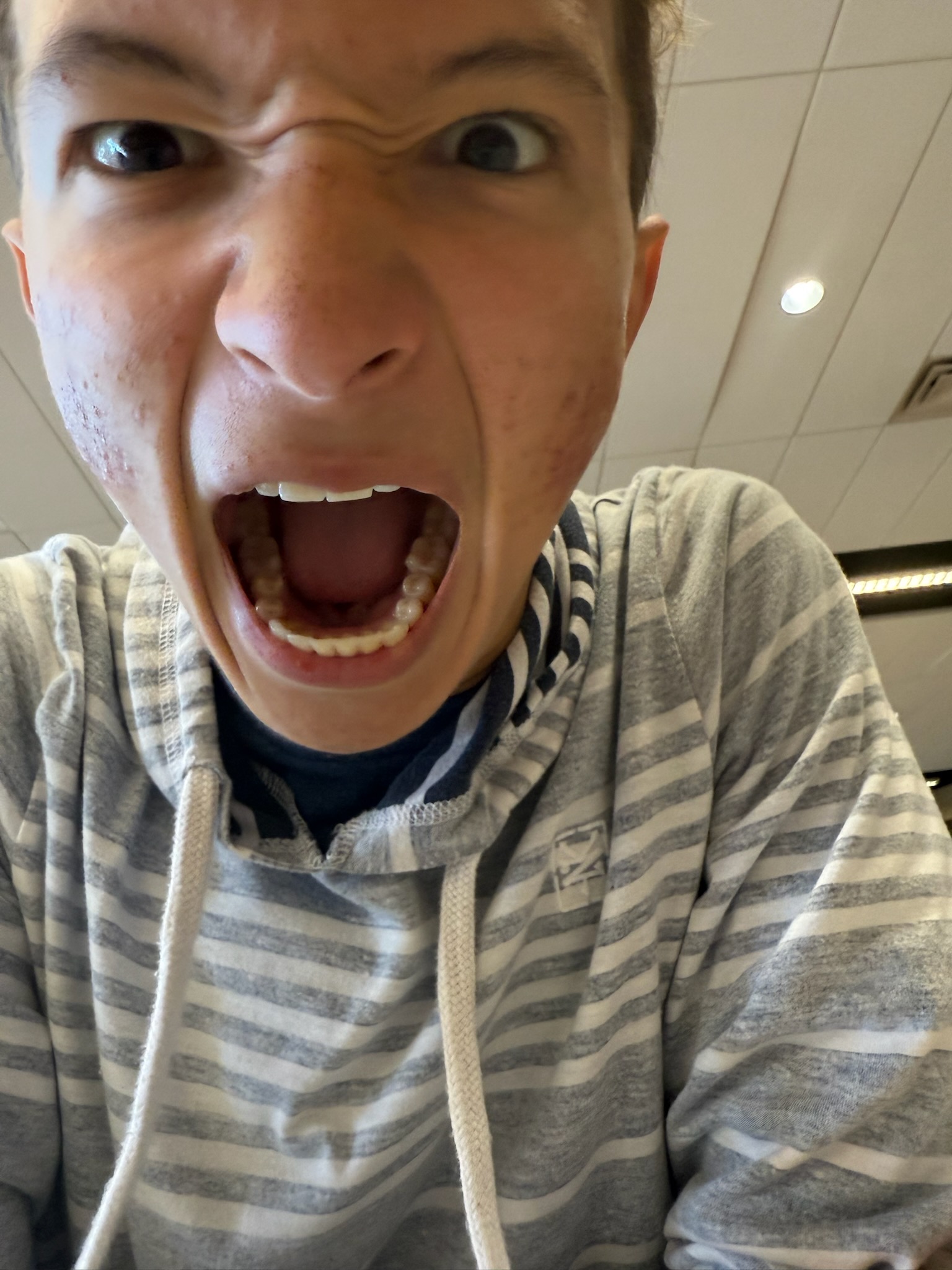 Open Wide